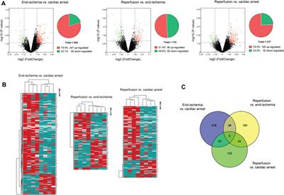 Activation of CCL21-GPR174/CCR7 on cardiac fibroblasts underlies myocardial ischemia/reperfusion injury